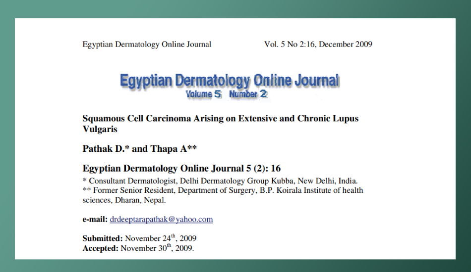 Squamous cell carcinoma in extensive lupus vulgaris